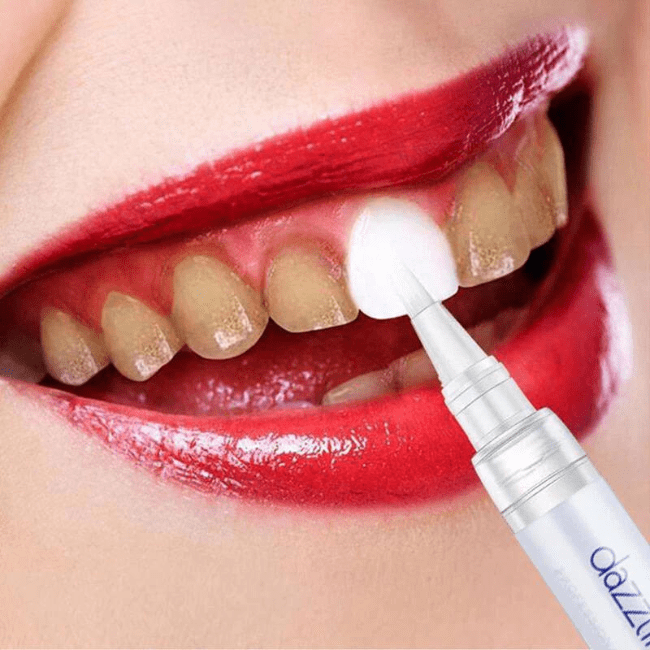 Instant Teeth Whitening Pen - Dazzling White For Men & Women - My Store
