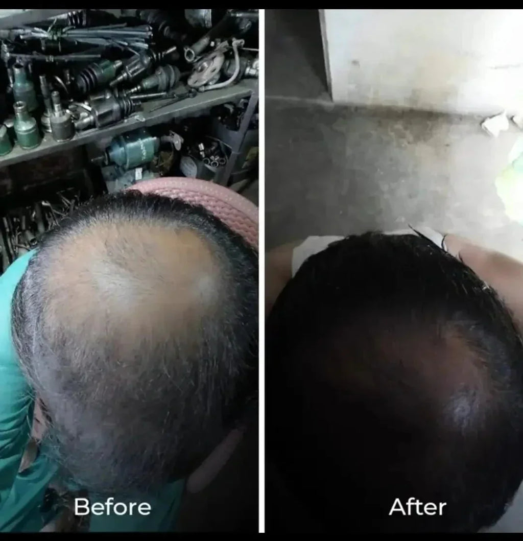 Intense hair growth oil | Made in Vietnam hair growth oil